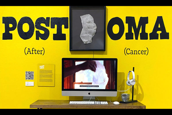 Postoma (After Cancer)